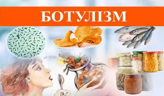 НЕВИДИМА ОТРУТА: ЩО ПОТРІБНО ЗНАТИ ПРО БОТУЛІЗМ, АБИ ВБЕРЕГТИ ЖИТТЯ